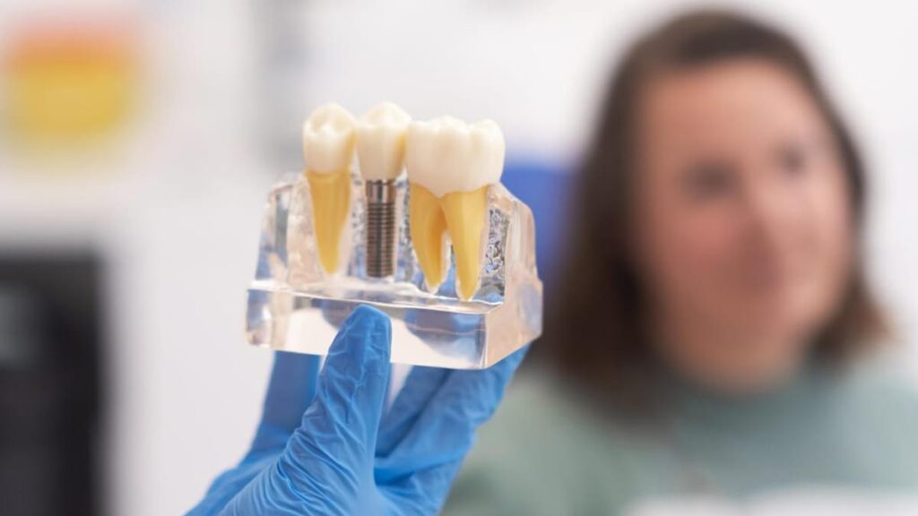 Recuperarea după implant dentar: ce trebuie să știi