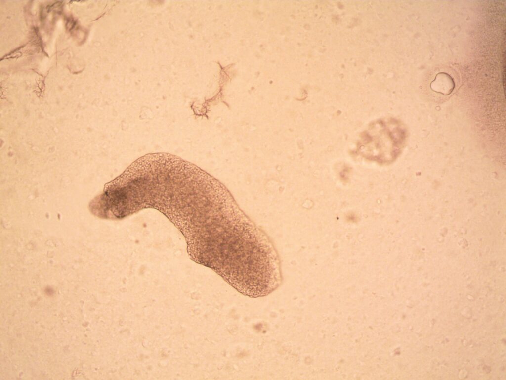 Alerta sanitară în India după creşterea numărului de cazuri de amoebă „mâncătoare de creier"