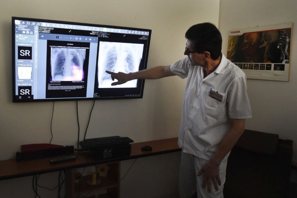 Un doctor studiază pe ecran radiografia unui plămân