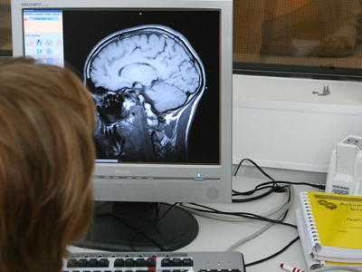 Modificările care au loc în creier atunci când ne deconectăm din cauza oboselii Modificările care au loc în creier atunci când ne deconectăm din cauza oboselii