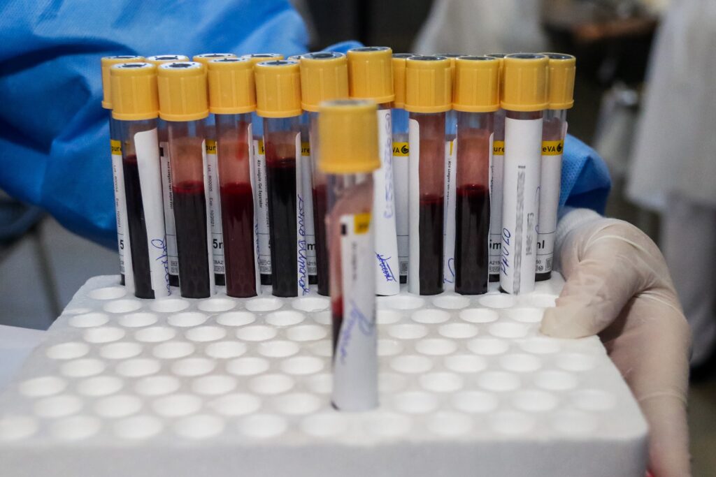 Un test de sânge pentru mai mult de 50 de tipuri de cancer ar putea contribui la accelerarea diagnosticării - studiu