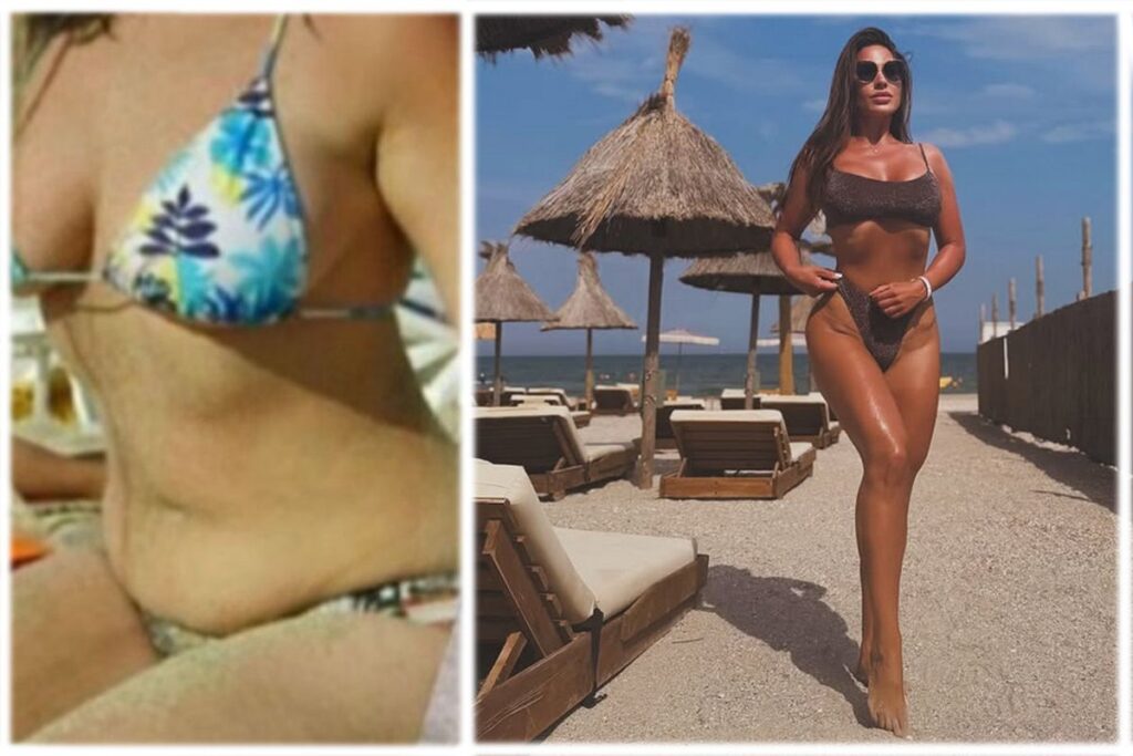 de la obezitate la culturism