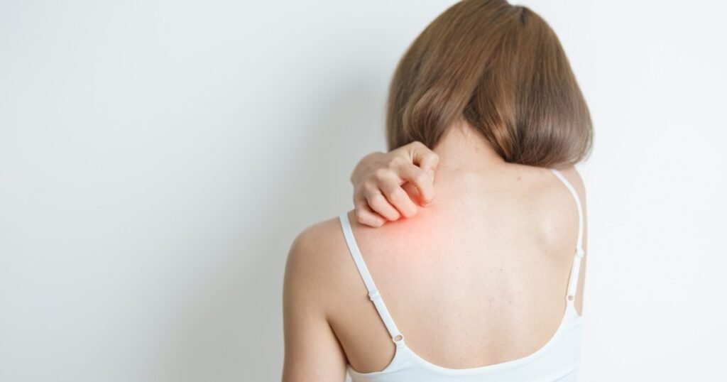 Caz de lepră confirmat în România. Ministrul Sănătății anunță trei suspiciuni la maseuze asiatice din Cluj-Napoca Caz de lepră confirmat în România. Ministrul Sănătății anunță trei suspiciuni la maseuze asiatice din Cluj-Napoca