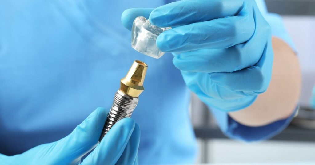Ce include prețul unui implant dentar complet: De la consultatie la control final Ce include prețul unui implant dentar complet: De la consultatie la control final